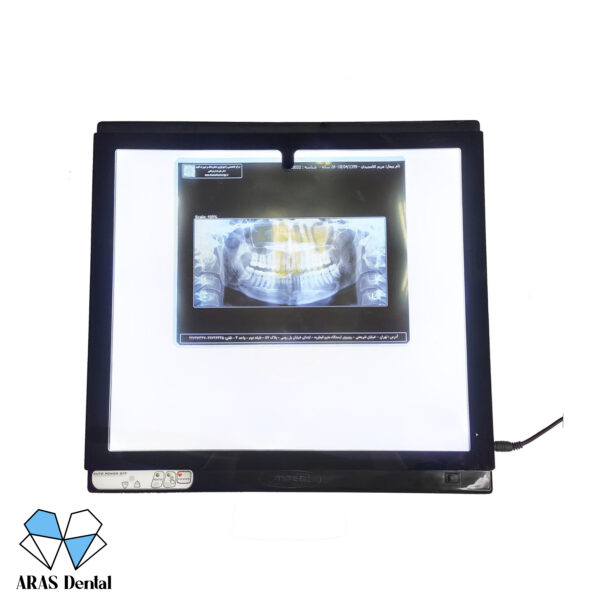 نگاتسکوپ دیجیتال عاج طب مدل CTX D
