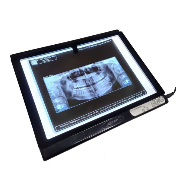 نگاتسکوپ دیجیتال عاج طب مدل MD D